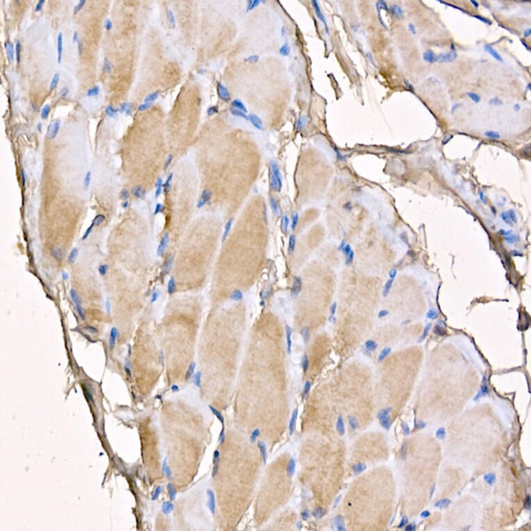 Immunohistochemistry - Anti-Myosin Antibody (A88758) - Antibodies.com