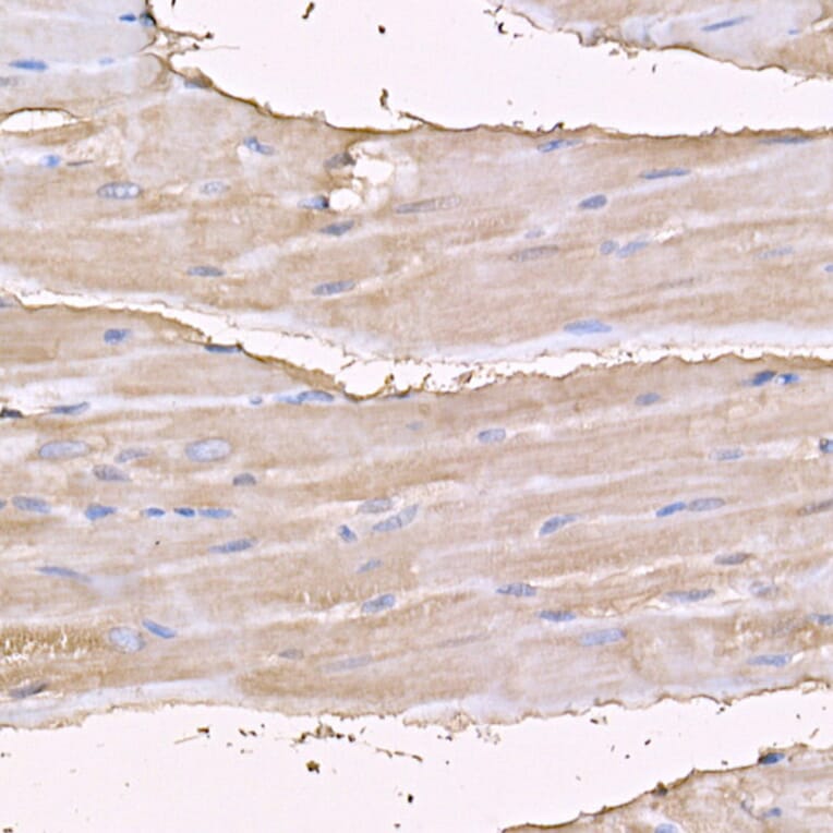 Immunohistochemistry - Anti-Myosin Antibody (A88758) - Antibodies.com