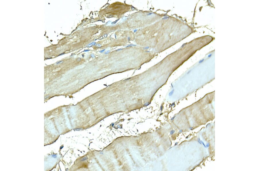 Immunohistochemistry - Anti-Myosin Antibody (A88758) - Antibodies.com