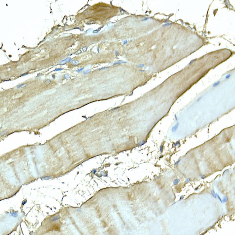 Immunohistochemistry - Anti-Myosin Antibody (A88758) - Antibodies.com