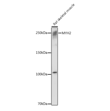 Western Blot - Anti-MYH2 Antibody (A88759) - Antibodies.com