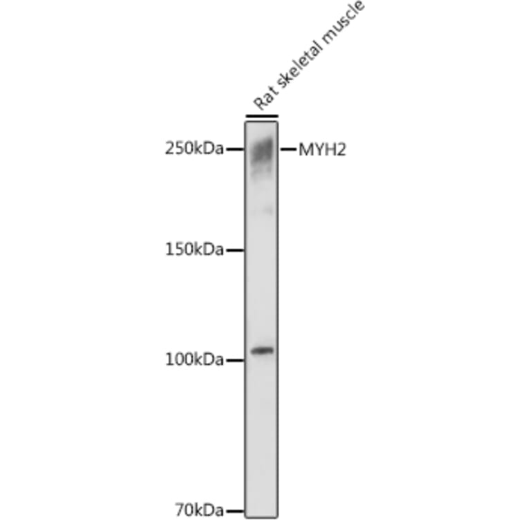 Western Blot - Anti-MYH2 Antibody (A88759) - Antibodies.com