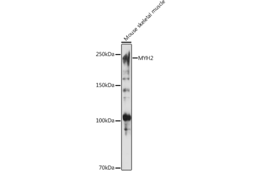 Western Blot - Anti-MYH2 Antibody (A88759) - Antibodies.com