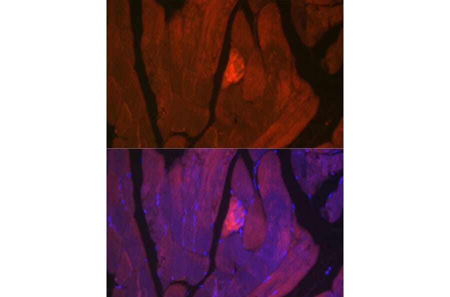 Immunofluorescence - Anti-MYH2 Antibody (A88759) - Antibodies.com