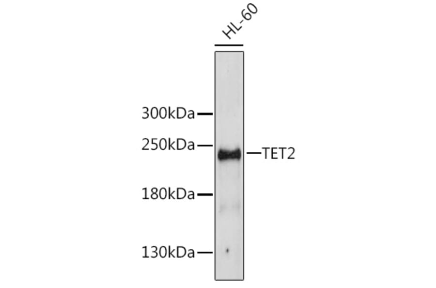 Western Blot - Anti-TET2 Antibody (A16273) - Antibodies.com