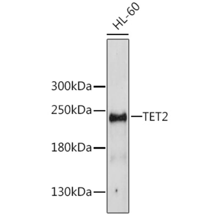 Western Blot - Anti-TET2 Antibody (A16273) - Antibodies.com