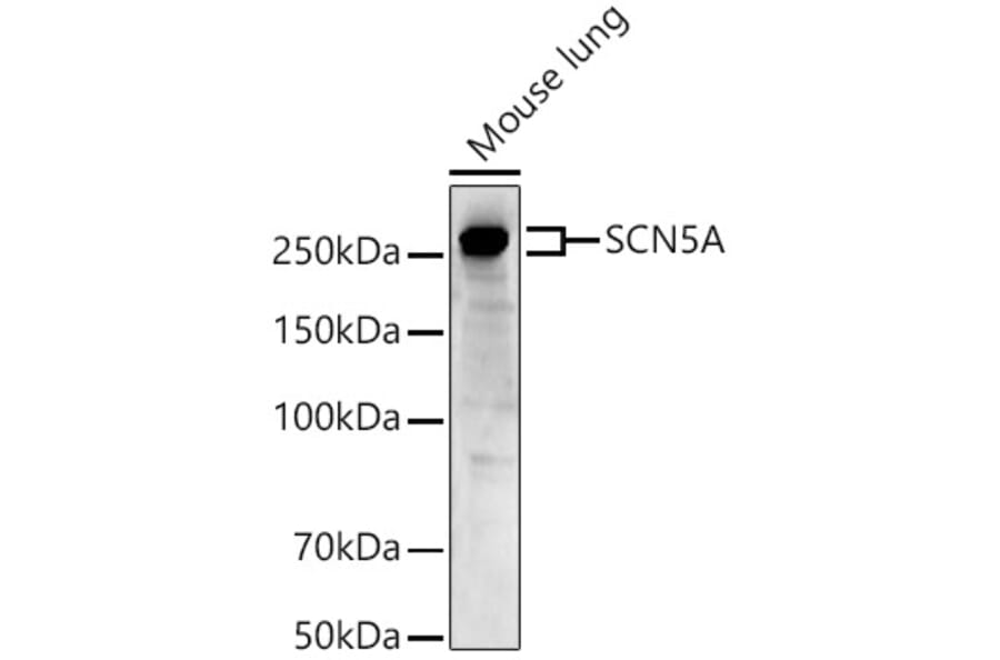Western Blot - Anti-Nav1.5/SCN5A Antibody (A88761) - Antibodies.com