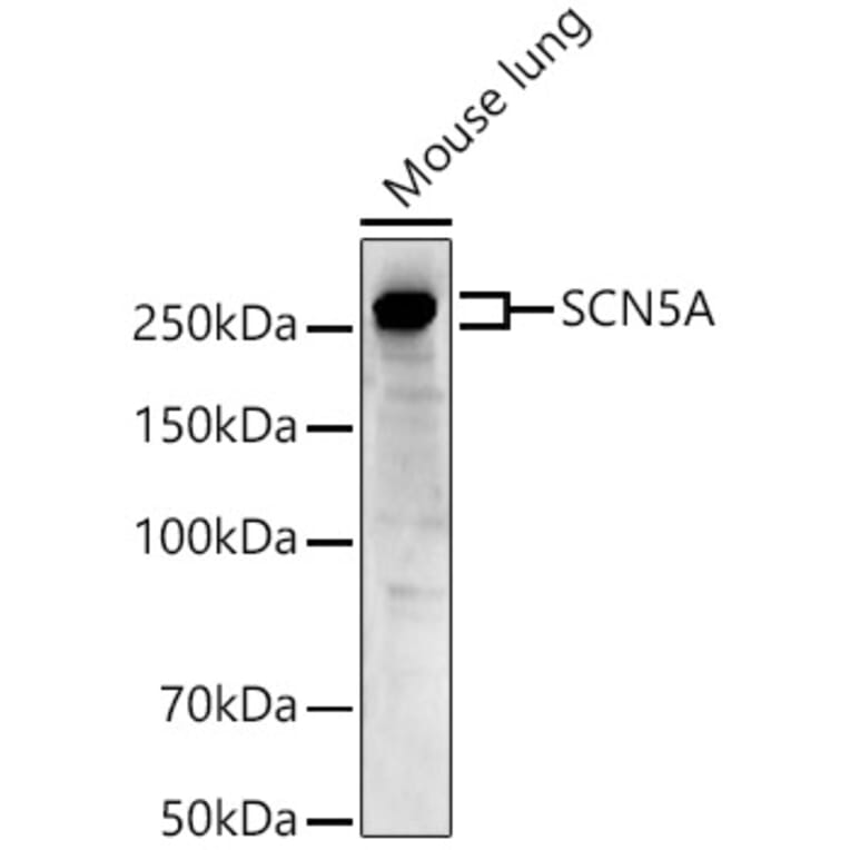 Western Blot - Anti-Nav1.5/SCN5A Antibody (A88761) - Antibodies.com