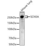 Western Blot - Anti-Nav1.5/SCN5A Antibody (A88761) - Antibodies.com