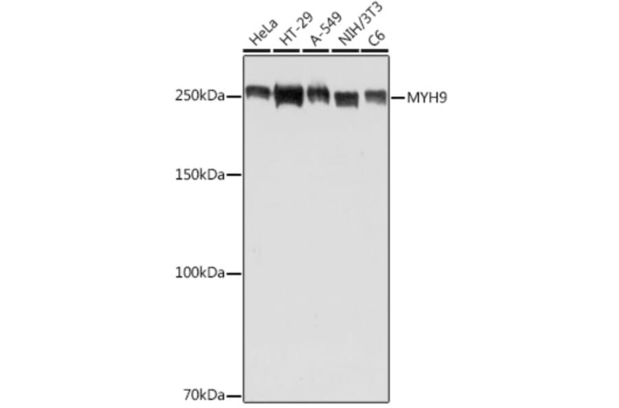 Western Blot - Anti-non-muscle Myosin IIA Antibody (A88762) - Antibodies.com