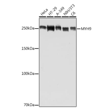 Western Blot - Anti-non-muscle Myosin IIA Antibody (A88762) - Antibodies.com