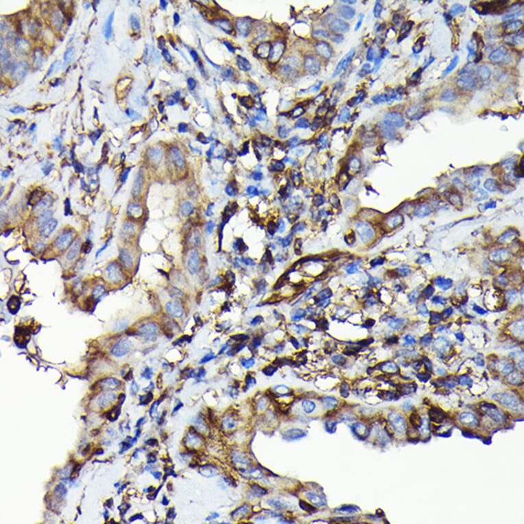 Immunohistochemistry - Anti-non-muscle Myosin IIA Antibody (A88762) - Antibodies.com