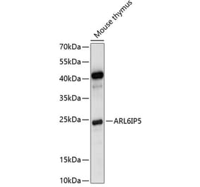 Western Blot - Anti-JWA Antibody (A88763) - Antibodies.com