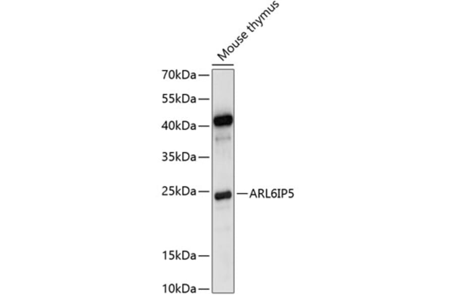Western Blot - Anti-JWA Antibody (A88763) - Antibodies.com