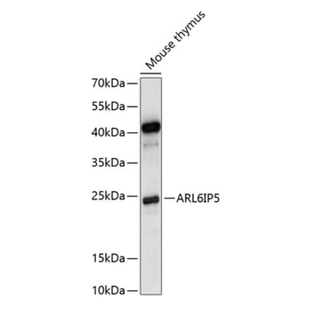 Western Blot - Anti-JWA Antibody (A88763) - Antibodies.com