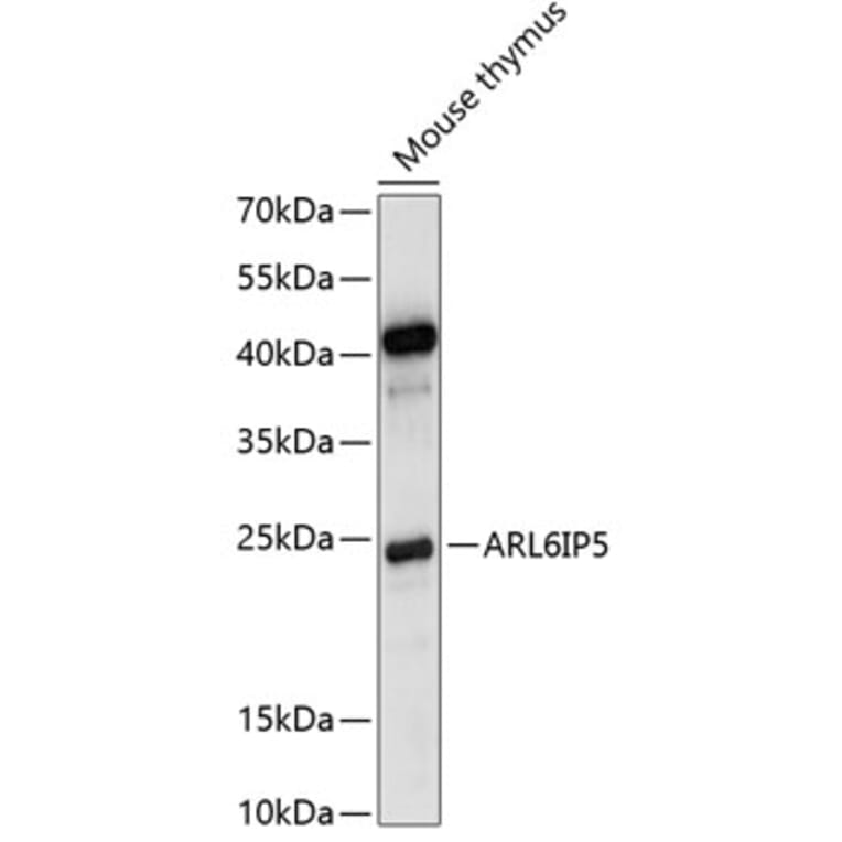 Western Blot - Anti-JWA Antibody (A88763) - Antibodies.com