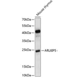 Western Blot - Anti-JWA Antibody (A88763) - Antibodies.com
