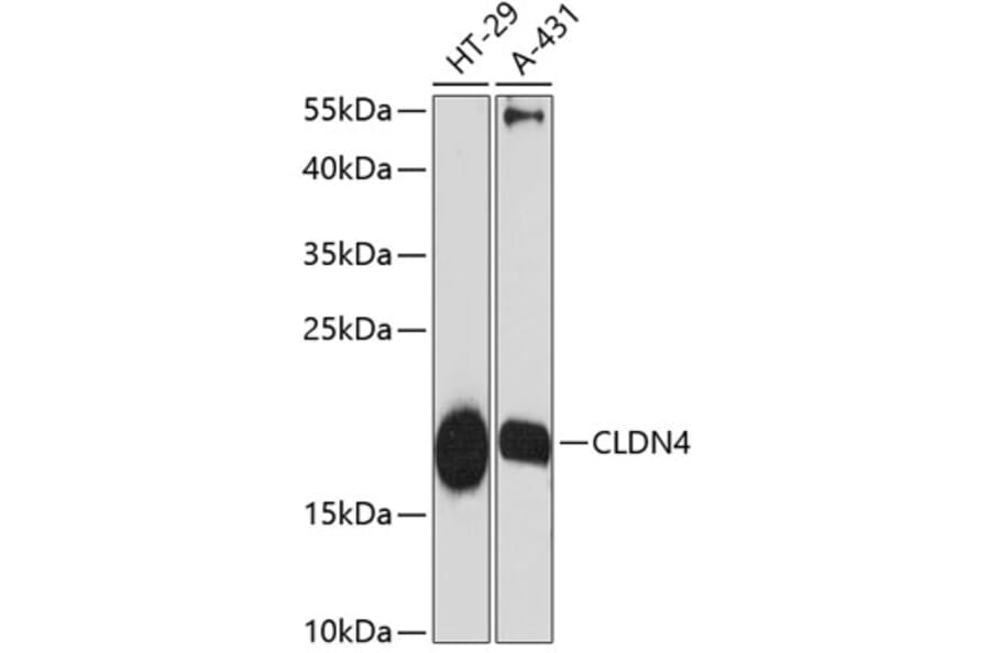 Western Blot - Anti-Claudin 4 Antibody (A88764) - Antibodies.com