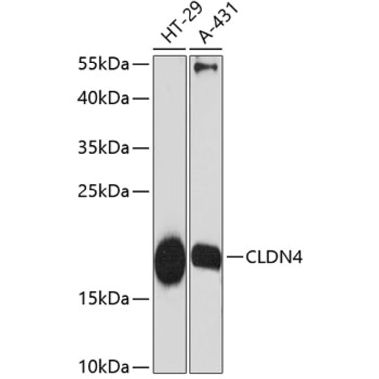 Western Blot - Anti-Claudin 4 Antibody (A88764) - Antibodies.com