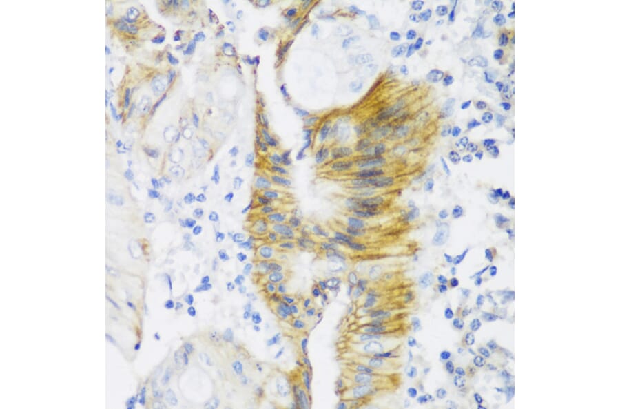 Immunohistochemistry - Anti-Claudin 4 Antibody (A88764) - Antibodies.com