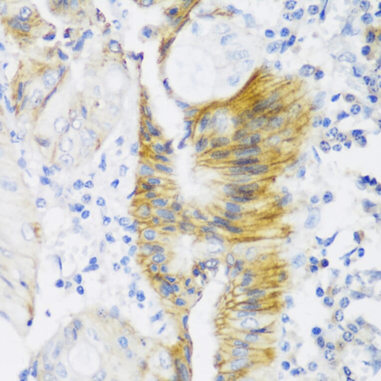 Immunohistochemistry - Anti-Claudin 4 Antibody (A88764) - Antibodies.com