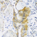 Immunohistochemistry - Anti-Claudin 4 Antibody (A88764) - Antibodies.com