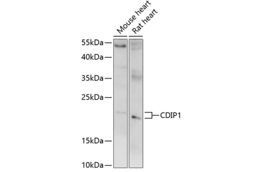 Western Blot - Anti-CDIP1 Antibody (A88765) - Antibodies.com