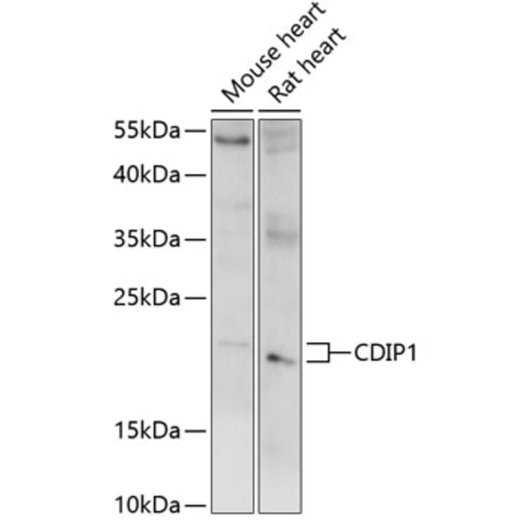 Western Blot - Anti-CDIP1 Antibody (A88765) - Antibodies.com