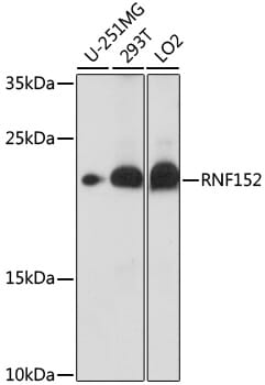 Western blot analysis of extracts of various cell lines, using Anti-RNF152 Antibody (A16608) at 1:1,000 dilution.
Secondary antibody: Goat Anti-Rabbit IgG (H+L) (HRP) (AS014) at 1:10,000 dilution.
Lysates / proteins: 25µg per lane.
Blocking buffer: 3% non-fat dry milk in TBST.
Detection: ECL Basic Kit (RM00020).
Exposure time: 10s.