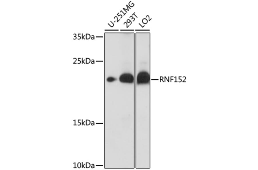 Western Blot - Anti-RNF152 Antibody (A88766) - Antibodies.com