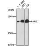 Western Blot - Anti-RNF152 Antibody (A88766) - Antibodies.com