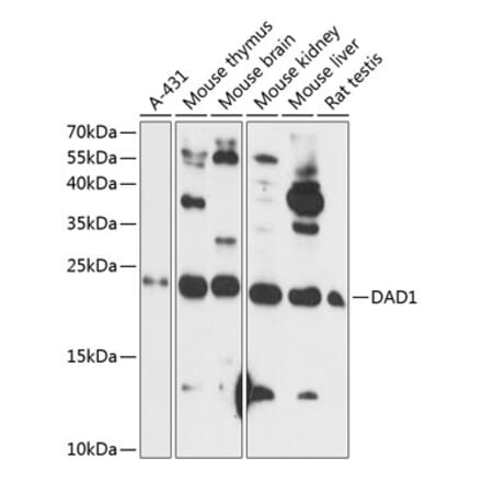 Western Blot - Anti-DAD1 Antibody (A88767) - Antibodies.com