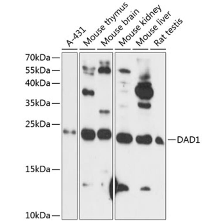 Western Blot - Anti-DAD1 Antibody (A88767) - Antibodies.com