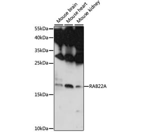 Western Blot - Anti-RAB22A Antibody (A88769) - Antibodies.com