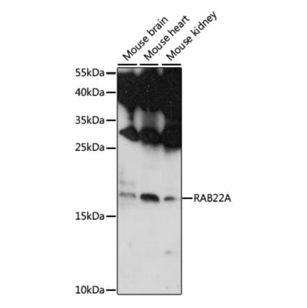 Western Blot - Anti-RAB22A Antibody (A88769) - Antibodies.com