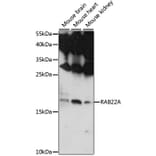 Western Blot - Anti-RAB22A Antibody (A88769) - Antibodies.com