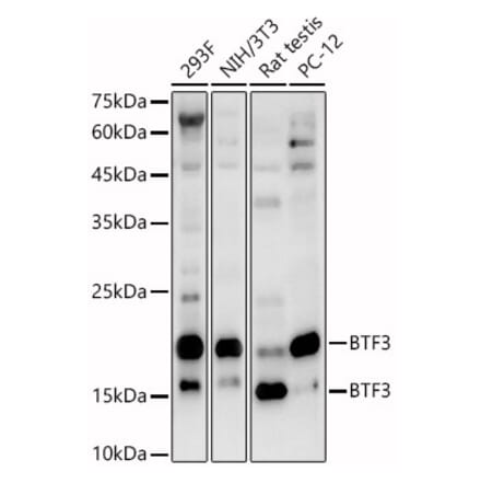 Western Blot - Anti-BTF3 Antibody (A88770) - Antibodies.com