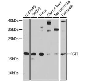 Western Blot - Anti-IGF1 Antibody (A88771) - Antibodies.com