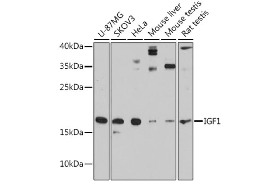 Western Blot - Anti-IGF1 Antibody (A88771) - Antibodies.com