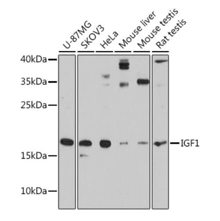 Western Blot - Anti-IGF1 Antibody (A88771) - Antibodies.com