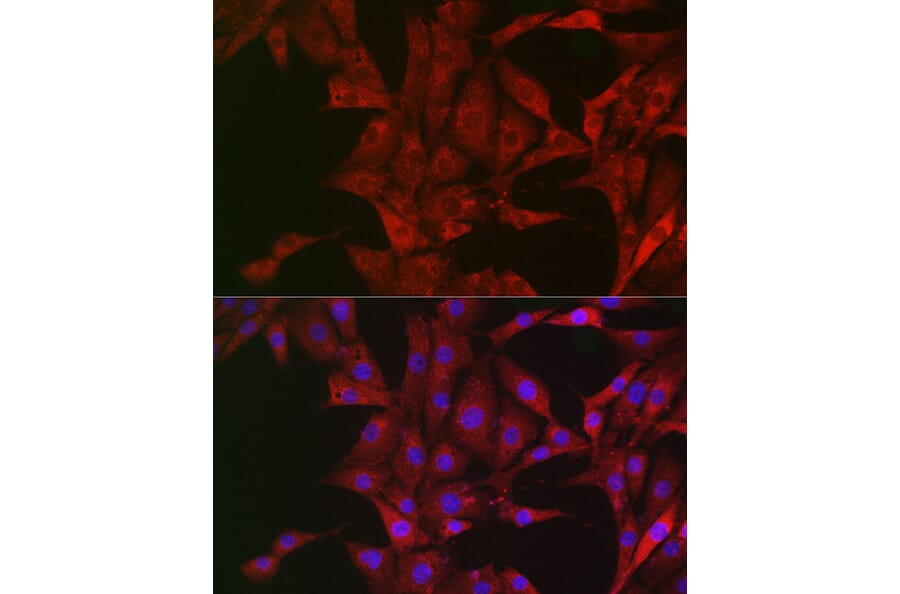Immunofluorescence - Anti-Bim Antibody (A88772) - Antibodies.com
