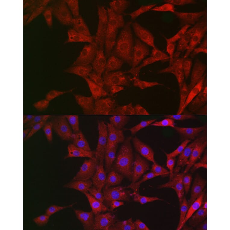Immunofluorescence - Anti-Bim Antibody (A88772) - Antibodies.com