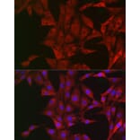 Immunofluorescence - Anti-Bim Antibody (A88772) - Antibodies.com