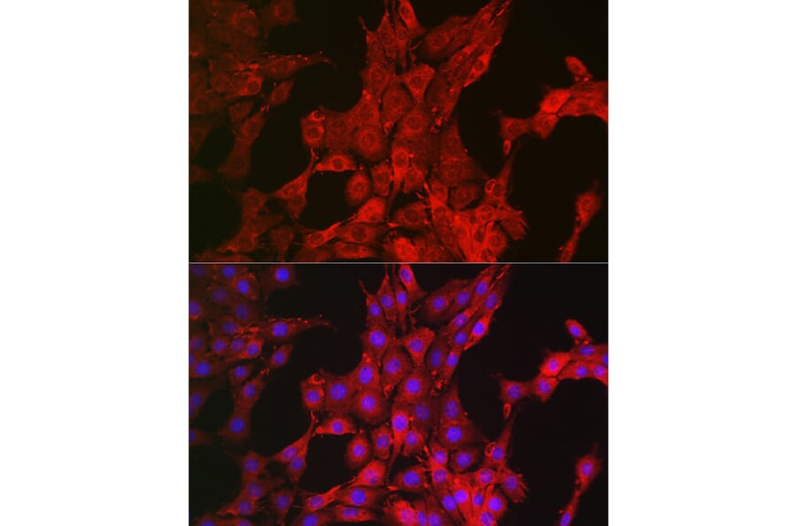 Immunofluorescence - Anti-Bim Antibody (A88772) - Antibodies.com