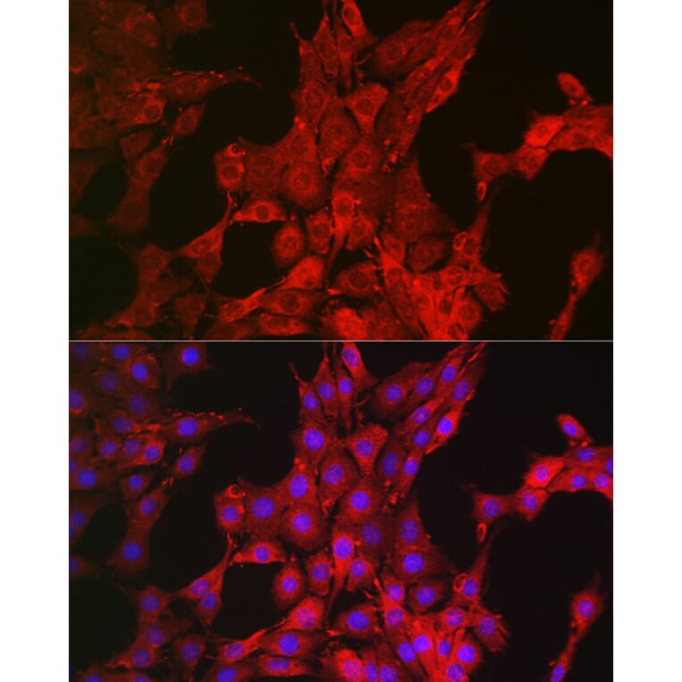 Immunofluorescence - Anti-Bim Antibody (A88772) - Antibodies.com