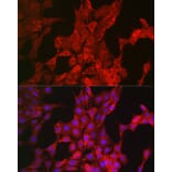 Immunofluorescence - Anti-Bim Antibody (A88772) - Antibodies.com