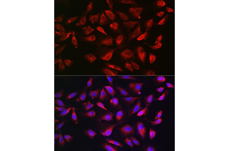 Immunofluorescence - Anti-Bim Antibody (A88772) - Antibodies.com