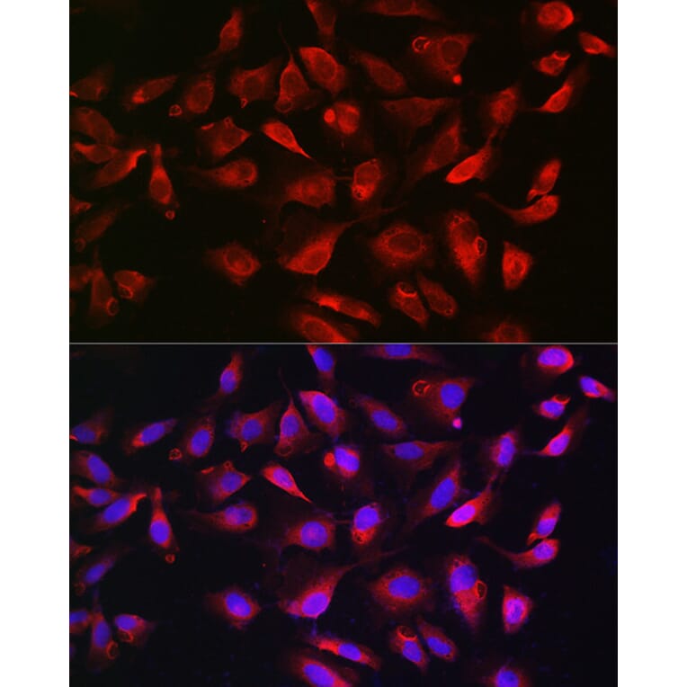 Immunofluorescence - Anti-Bim Antibody (A88772) - Antibodies.com