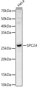 Western blot analysis of extracts of various cell lines, using Anti-SPC24 Antibody (A16601) at 1:1,000 dilution.
Secondary antibody: Goat Anti-Rabbit IgG (H+L) (HRP) (AS014) at 1:10,000 dilution.
Lysates / proteins: 25µg per lane.
Blocking buffer: 3% non-fat dry milk in TBST.
Detection: ECL Basic Kit (RM00020).
Exposure time: 30s.
