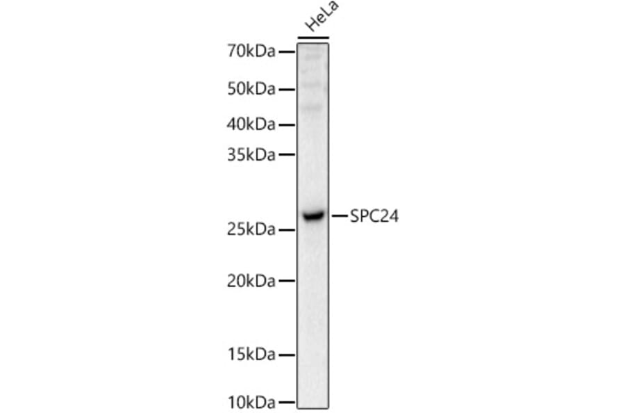 Western Blot - Anti-SPC24 Antibody (A88773) - Antibodies.com